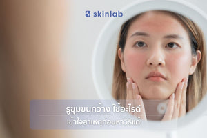 รูขุมขนกว้าง ใช้อะไรดี? หาสาเหตุ วิธีแก้ที่ได้ผลจริงจาก skinlab